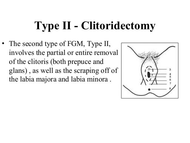 clitoris stretching labia mutilation circumcision fgm Interracial erotic art